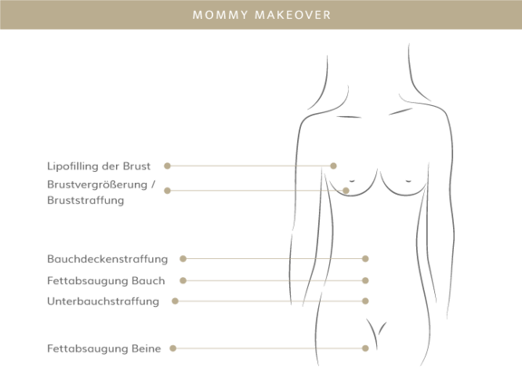 Mommy Makeover, Plastische & Ästhetische Chirurgie in Mannheim, Dr. Schumacher